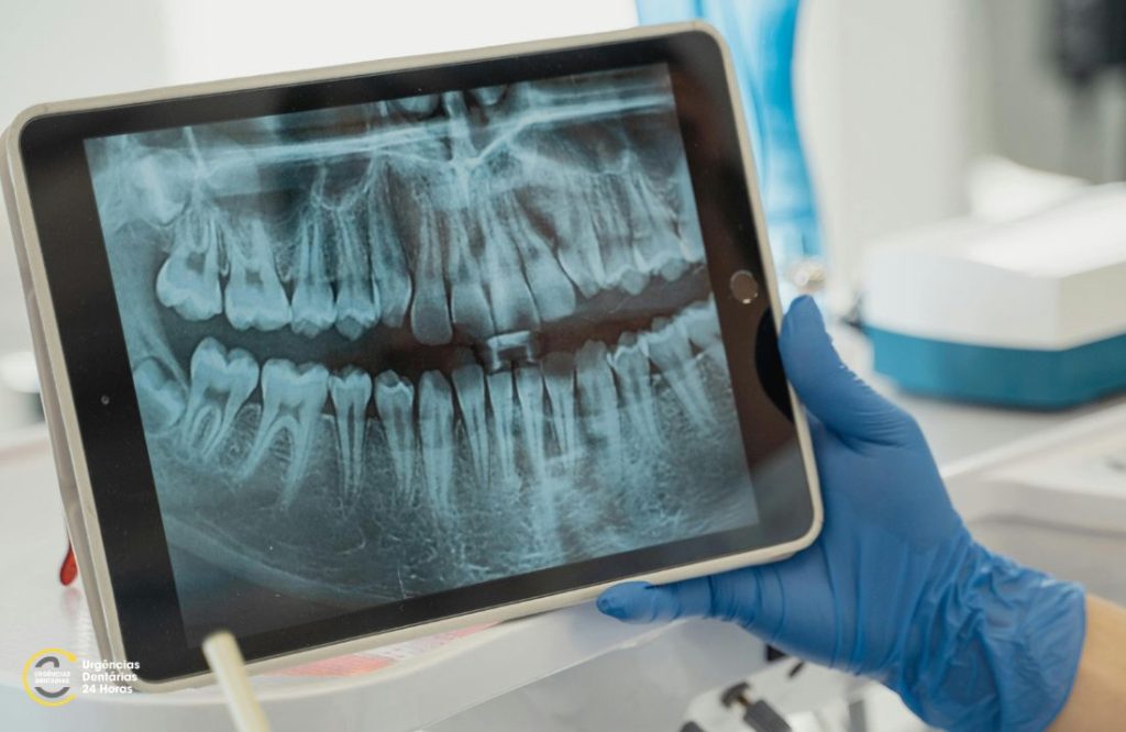 Urgências Dentárias - Porto - Sinais que Pode Estar com um Problema Dentário e Não Pode Ignorar